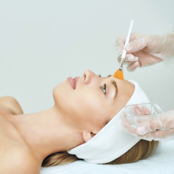 Peeling Químico