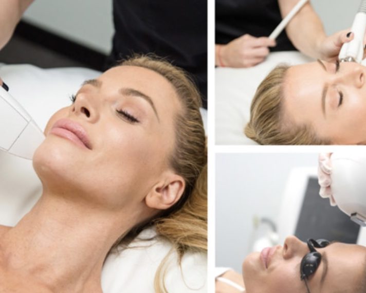 TriBella™ – Rejuvenecimiento Facial Completo. (IPL + Radiofrecuencia + RF Nanofraccionada)