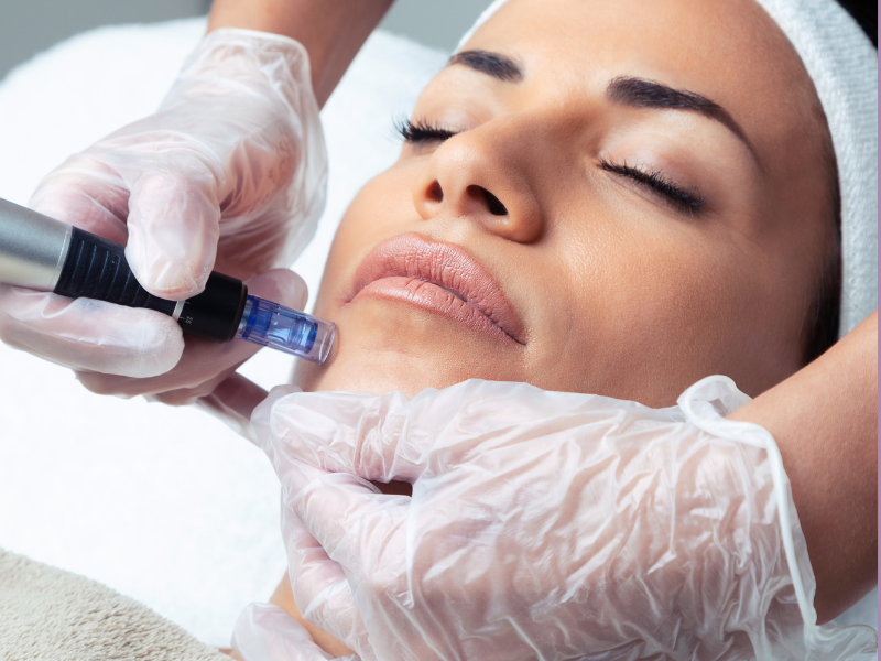 Microneedling